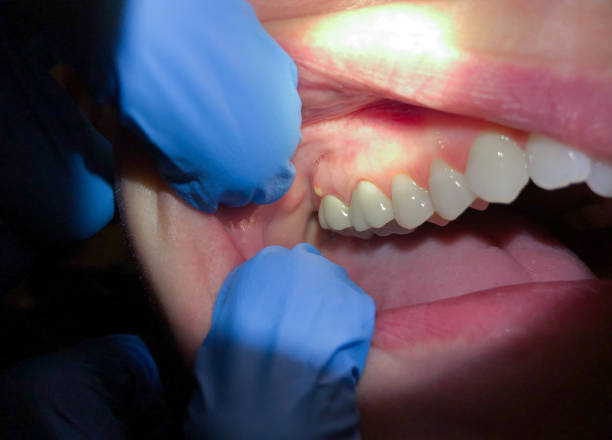 Best Emergency Treatment for Jaw Pain or Injury in Ewa Gentry, HI